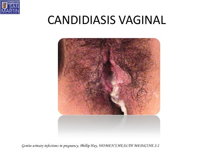 pool party anal porn causes of anal candidas